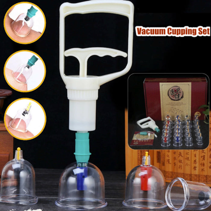 Enhanced 32-Piece Cupping Therapy Kit for High-End Massage Experience: transparent, white cupping therapy set, medical/utilit